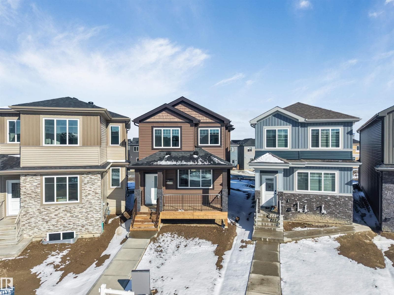 22932 80 AV NW photo 2