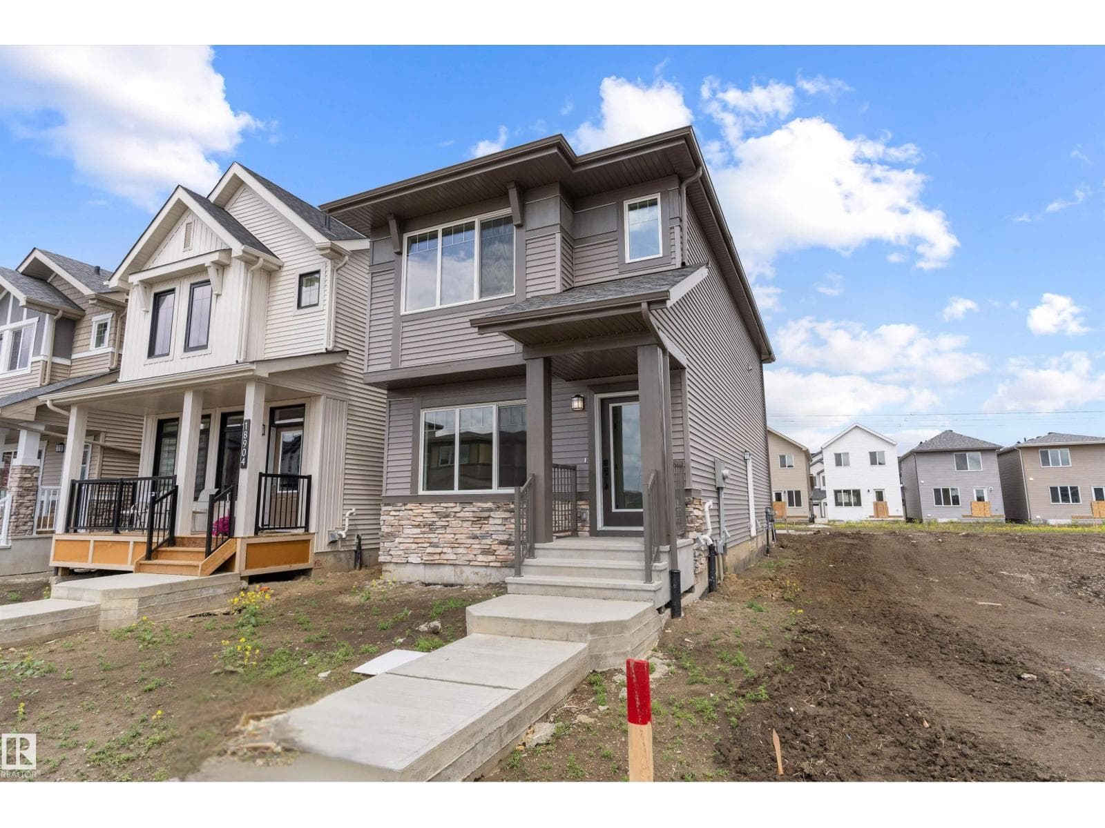 18844 28 AV NW — photo 2
